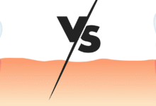 Difference Between Veneers and Crowns